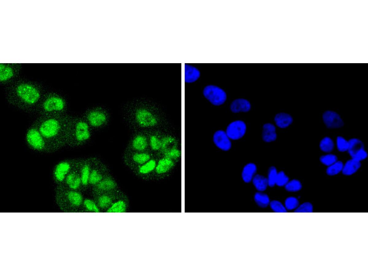ICC staining of FANCD2 in MCF-7 cells (green). Formalin fixed cells were permeabilized with 0.1% Triton X-100 in TBS for 10 minutes at room temperature and blocked with 1% Blocker BSA for 15 minutes at room temperature. Cells were probed with the primary antibody (ET1611-67, 1/50) for 1 hour at room temperature, washed with PBS. Alexa Fluor®488 Goat anti-Rabbit IgG was used as the secondary antibody at 1/1,000 dilution. The nuclear counter stain is DAPI (blue).