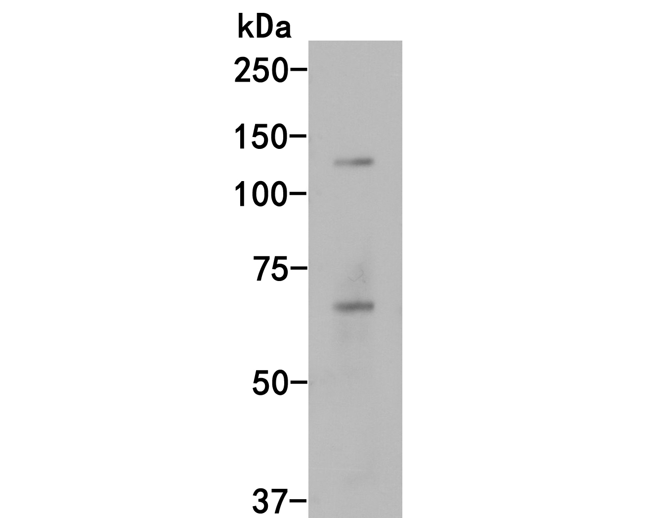 Western blot analysis of Phospho-Tau(S396) on SHSY5Y cell lysates. Proteins were transferred to a PVDF membrane and blocked with 5% BSA in PBS for 1 hour at room temperature. The primary antibody (ET1611-68, 1/500) was used in 5% BSA at room temperature for 2 hours. Goat Anti-Rabbit IgG - HRP Secondary Antibody (HA1001) at 1:5,000 dilution was used for 1 hour at room temperature.