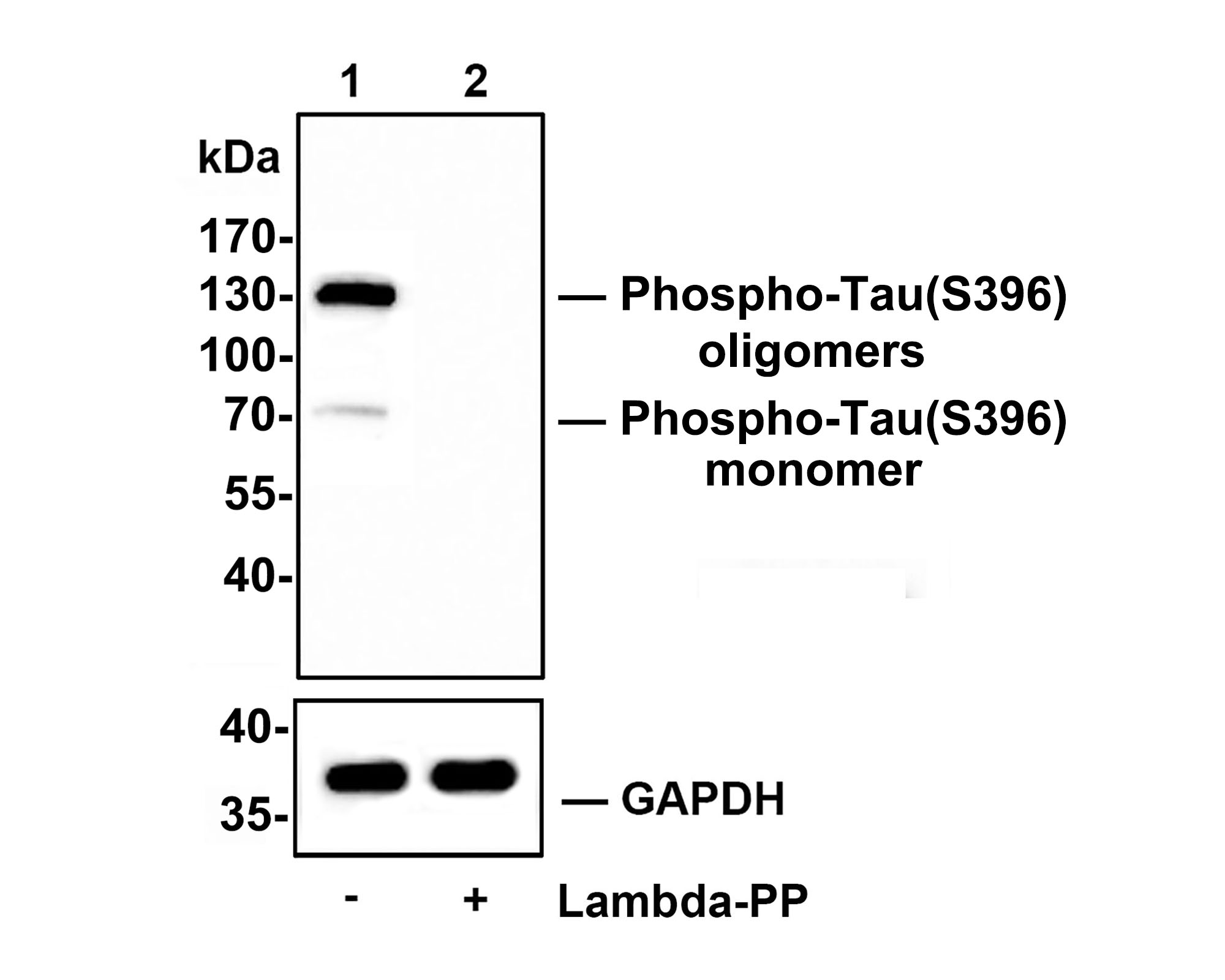 Western blot analysis of Phospho-Tau(S396) on SHSY5Y cell lysates.<br />
<br />
Lane 1: SHSY5Y cells, whole cell lysate, 10ug/lane<br />
Lane 2: SHSY5Y cells treated with 2.8ug/ul lambda-PP for 30 minutes, whole cell lysates, 10ug/lane<br />
<br />
All lanes :<br />
Anti-Phospho-Tau(S396) antibody (ET1611-68) at 1/500 dilution. Anti-GAPDH antibody (ET1601-4) at 1/10,000 dilution. Goat Anti-Rabbit IgG H&L (HRP) (HA1001) at 1/200,000 dilution.<br />
<br />
Predicted band size: 79 kDa<br />
Observed band size: 70/130 kDa<br />
<br />
Blocking and diluting buffer: 5% BSA.<br />
<br />
Exposure time: 2 minutes 34 seconds