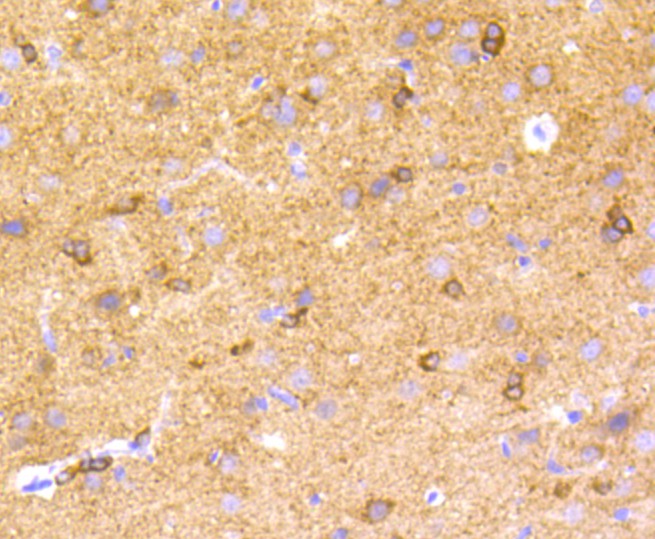 ICC staining of Phospho-Tau(S396) in PC-12 cells (green). Formalin fixed cells were permeabilized with 0.1% Triton X-100 in TBS for 10 minutes at room temperature and blocked with 1% Blocker BSA for 15 minutes at room temperature. Cells were probed with the primary antibody (ET1611-68, 1/50) for 1 hour at room temperature, washed with PBS. Alexa Fluor®488 Goat anti-Rabbit IgG was used as the secondary antibody at 1/1,000 dilution. The nuclear counter stain is DAPI (blue).
