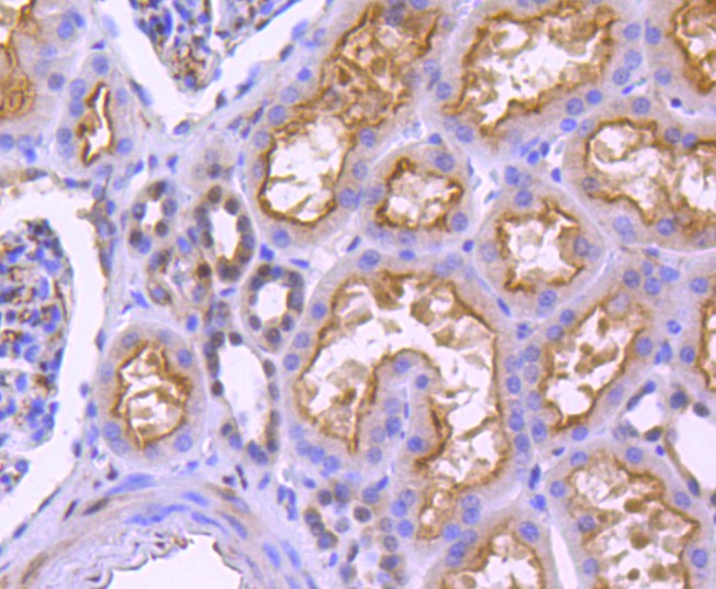 Immunohistochemical analysis of paraffin-embedded human kidney tissue using anti-Phospho-YAP1 (S127) antibody. The section was pre-treated using heat mediated antigen retrieval with Tris-EDTA buffer (pH 8.0-8.4) for 20 minutes.The tissues were blocked in 5% BSA for 30 minutes at room temperature, washed with ddH2O and PBS, and then probed with the primary antibody (ET1611-69, 1/50) for 30 minutes at room temperature. The detection was performed using an HRP conjugated compact polymer system. DAB was used as the chromogen. Tissues were counterstained with hematoxylin and mounted with DPX.