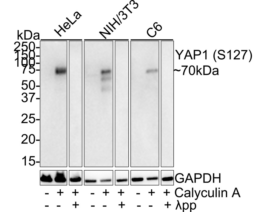 Western blot analysis of Phospho-YAP1 (S127) on different lysates with Rabbit anti-Phospho-YAP1 (S127) antibody (ET1611-69) at 1/5,000 dilution.<br />
<br />
Lane 1: HeLa whole cell lysate<br />
Lane 2: HeLa treated with 100nM Calyculin A for 30 minutes whole cell lysate<br />
Lane 3: HeLa treated with 100nM Calyculin A for 30 minutes then treated with λpp for 1 hour whole cell lysate<br />
Lane 4: NIH/3T3 whole cell lysate<br />
Lane 5: NIH/3T3 treated with 100nM Calyculin A for 30 minutes whole cell lysate<br />
Lane 6: NIH/3T3 treated with 100nM Calyculin A for 30 minutes then treated with λpp for 1 hour whole cell lysate<br />
Lane 7: C6 whole cell lysate<br />
Lane 8: C6 treated with 100nM Calyculin A for 30 minutes whole cell lysate<br />
Lane 9: C6 treated with 100nM Calyculin A for 30 minutes then treated with λpp for 1 hour whole cell lysate<br />
<br />
Lysates/proteins at 10 µg/Lane.<br />
<br />
Predicted band size: 54 kDa<br />
Observed band size: 70 kDa<br />
<br />
Exposure time: 1 minute 6 seconds;<br />
<br />
4-20% SDS-PAGE gel.<br />
<br />
Proteins were transferred to a PVDF membrane and blocked with 5% NFDM/TBST for 1 hour at room temperature. The primary antibody (ET1611-69) at 1/5,000 dilution was used in 5% NFDM/TBST at room temperature for 2 hours. Goat Anti-Rabbit IgG - HRP Secondary Antibody (HA1001) at 1:100,000 dilution was used for 1 hour at room temperature.