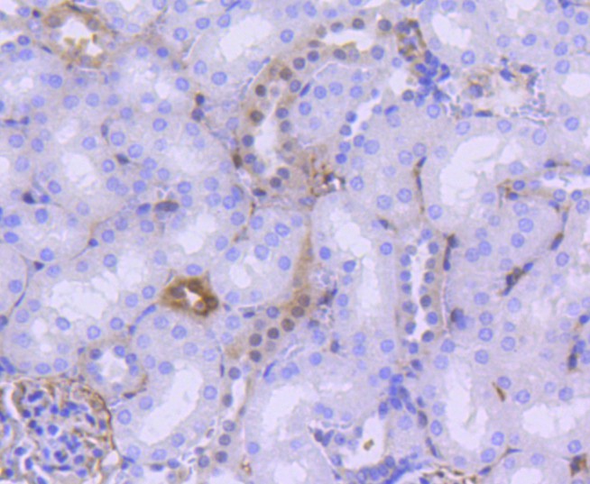Immunohistochemical analysis of paraffin-embedded mouse kidney tissue using anti-Phospho-YAP1 (S127) antibody. The section was pre-treated using heat mediated antigen retrieval with Tris-EDTA buffer (pH 8.0-8.4) for 20 minutes.The tissues were blocked in 5% BSA for 30 minutes at room temperature, washed with ddH2O and PBS, and then probed with the primary antibody (ET1611-69, 1/50) for 30 minutes at room temperature. The detection was performed using an HRP conjugated compact polymer system. DAB was used as the chromogen. Tissues were counterstained with hematoxylin and mounted with DPX.