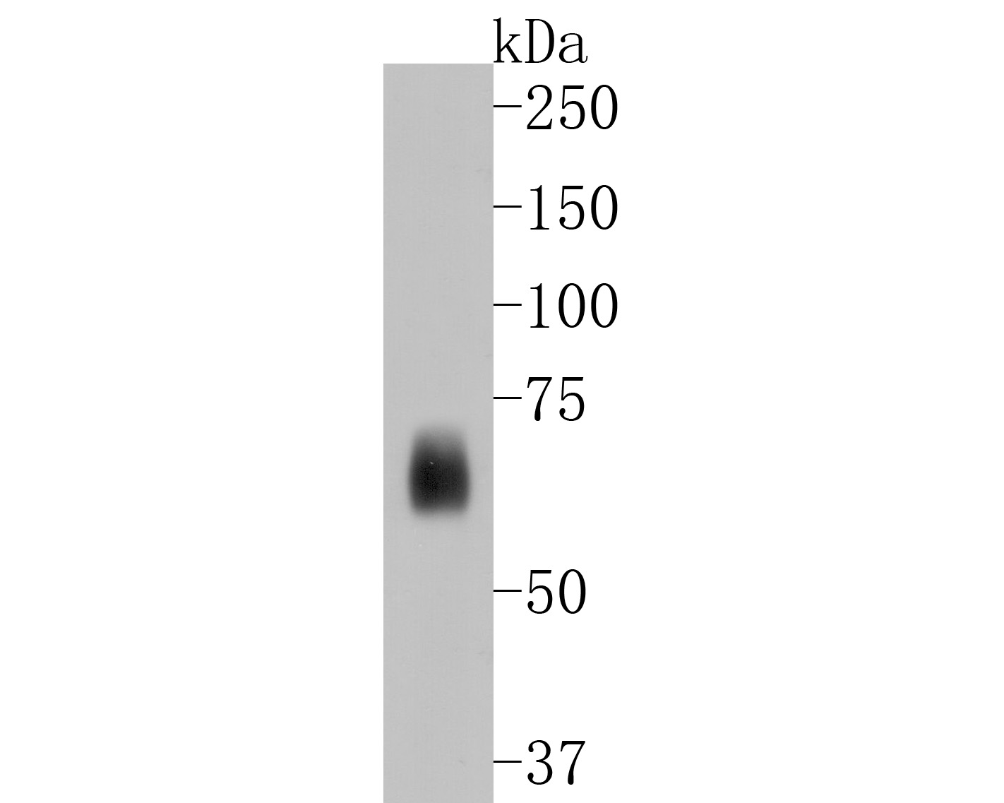 Western blot analysis of Kv1.1 potassium channel on human brain tissue lysates. Proteins were transferred to a PVDF membrane and blocked with 5% BSA in PBS for 1 hour at room temperature. The primary antibody (ET1611-7, 1/500) was used in 5% BSA at room temperature for 2 hours. Goat Anti-Rabbit IgG - HRP Secondary Antibody (HA1001) at 1:5,000 dilution was used for 1 hour at room temperature.
