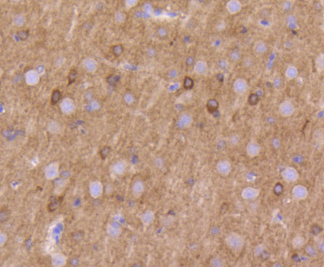 Immunohistochemical analysis of paraffin-embedded rat brain tissue using anti-Kv1.1 potassium channel antibody. The section was pre-treated using heat mediated antigen retrieval with Tris-EDTA buffer (pH 8.0-8.4) for 20 minutes.The tissues were blocked in 5% BSA for 30 minutes at room temperature, washed with ddH2O and PBS, and then probed with the primary antibody (ET1611-7, 1/50) for 30 minutes at room temperature. The detection was performed using an HRP conjugated compact polymer system. DAB was used as the chromogen. Tissues were counterstained with hematoxylin and mounted with DPX.