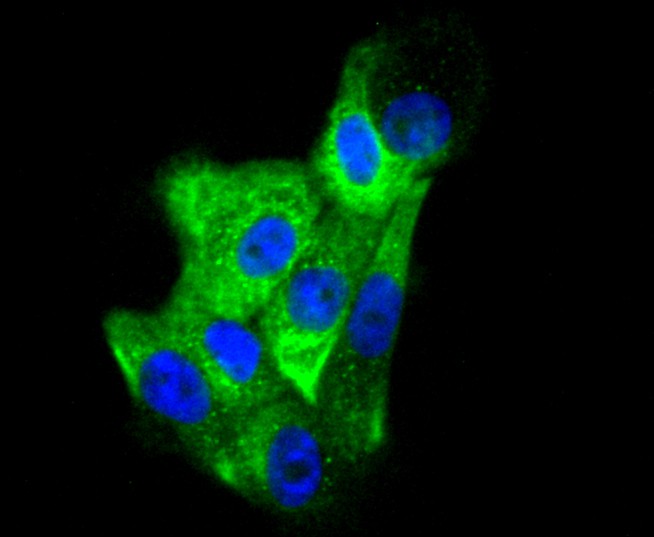 ICC staining of Cytokeratin 6 in A431 cells (green). Formalin fixed cells were permeabilized with 0.1% Triton X-100 in TBS for 10 minutes at room temperature and blocked with 10% negative goat serum for 15 minutes at room temperature. Cells were probed with the primary antibody (ET1611-70, 1/100) for 1 hour at room temperature, washed with PBS. Alexa Fluor®488 conjugate-Goat anti-Rabbit IgG was used as the secondary antibody at 1/1,000 dilution. The nuclear counter stain is DAPI (blue).