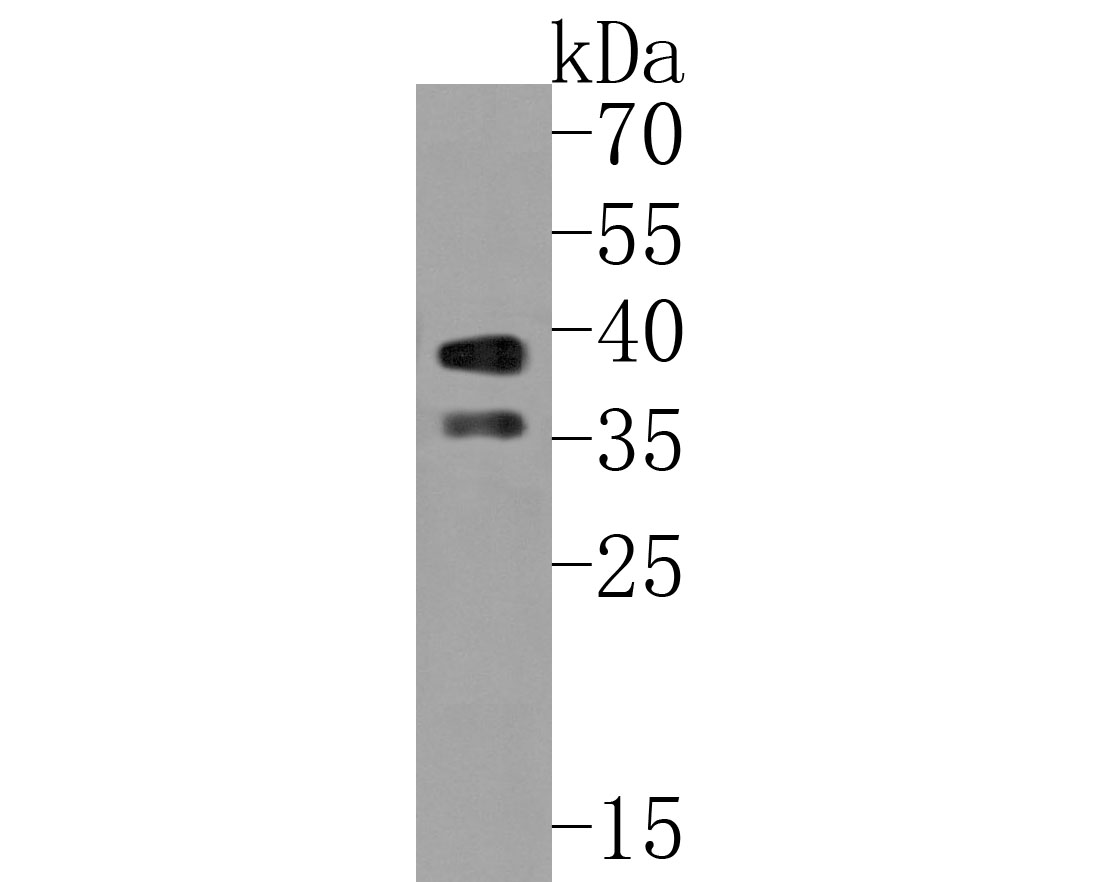 Western blot analysis of SIRT2 on 293 cell lysates. Proteins were transferred to a PVDF membrane and blocked with 5% BSA in PBS for 1 hour at room temperature. The primary antibody (ET1611-72, 1/500) was used in 5% BSA at room temperature for 2 hours. Goat Anti-Rabbit IgG - HRP Secondary Antibody (HA1001) at 1:5,000 dilution was used for 1 hour at room temperature.