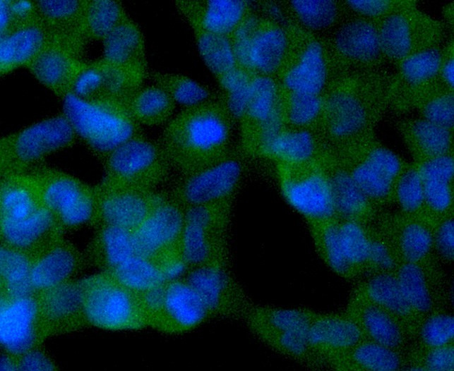 ICC staining of SIRT2 in 293 cells (green). Formalin fixed cells were permeabilized with 0.1% Triton X-100 in TBS for 10 minutes at room temperature and blocked with 1% Blocker BSA for 15 minutes at room temperature. Cells were probed with the primary antibody (ET1611-72, 1/50) for 1 hour at room temperature, washed with PBS. Alexa Fluor®488 Goat anti-Rabbit IgG was used as the secondary antibody at 1/1,000 dilution. The nuclear counter stain is DAPI (blue).