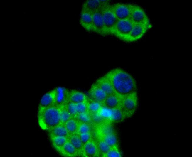 ICC staining of SIRT2 in PC-12 cells (green). Formalin fixed cells were permeabilized with 0.1% Triton X-100 in TBS for 10 minutes at room temperature and blocked with 1% Blocker BSA for 15 minutes at room temperature. Cells were probed with the primary antibody (ET1611-72, 1/50) for 1 hour at room temperature, washed with PBS. Alexa Fluor®488 Goat anti-Rabbit IgG was used as the secondary antibody at 1/1,000 dilution. The nuclear counter stain is DAPI (blue).