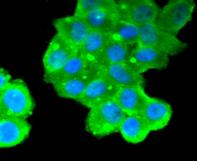 ICC staining of MUC16 in Hela cells (green). Formalin fixed cells were permeabilized with 0.1% Triton X-100 in TBS for 10 minutes at room temperature and blocked with 1% Blocker BSA for 15 minutes at room temperature. Cells were probed with the primary antibody (ET1611-73, 1/50) for 1 hour at room temperature, washed with PBS. Alexa Fluor®488 Goat anti-Rabbit IgG was used as the secondary antibody at 1/1,000 dilution. The nuclear counter stain is DAPI (blue).