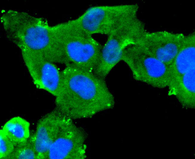 ICC staining of MUC16 in SKOV-3 cells (green). Formalin fixed cells were permeabilized with 0.1% Triton X-100 in TBS for 10 minutes at room temperature and blocked with 1% Blocker BSA for 15 minutes at room temperature. Cells were probed with the primary antibody (ET1611-73, 1/50) for 1 hour at room temperature, washed with PBS. Alexa Fluor®488 Goat anti-Rabbit IgG was used as the secondary antibody at 1/1,000 dilution. The nuclear counter stain is DAPI (blue).