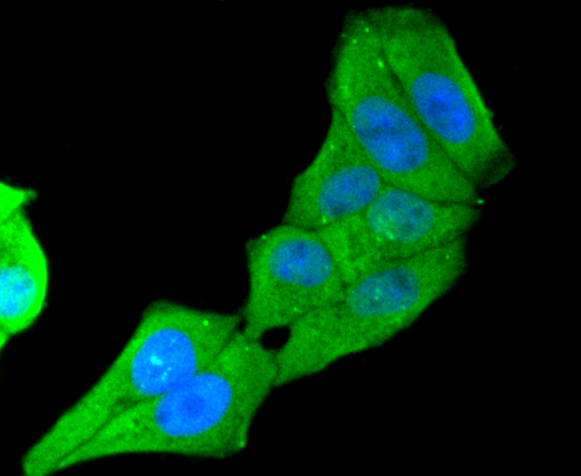 ICC staining of MUC16 in Hela cells (green). Formalin fixed cells were permeabilized with 0.1% Triton X-100 in TBS for 10 minutes at room temperature and blocked with 1% Blocker BSA for 15 minutes at room temperature. Cells were probed with the primary antibody (ET1611-74, 1/50) for 1 hour at room temperature, washed with PBS. Alexa Fluor®488 Goat anti-Rabbit IgG was used as the secondary antibody at 1/1,000 dilution. The nuclear counter stain is DAPI (blue).