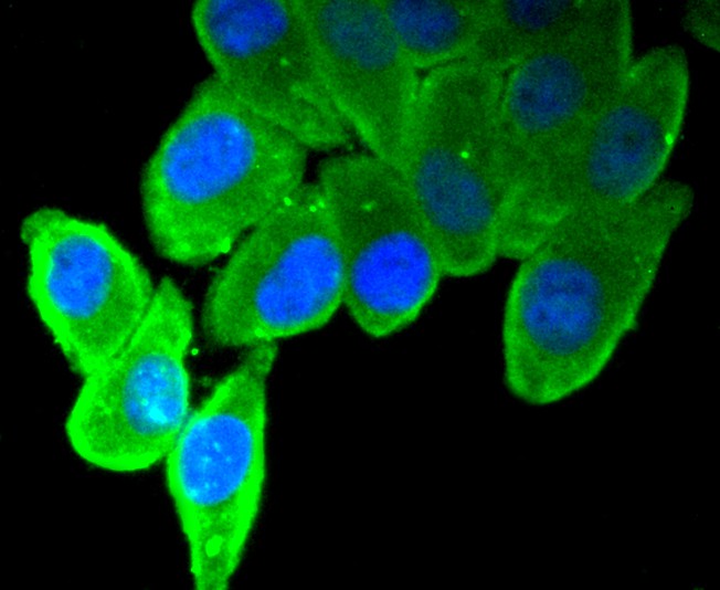 ICC staining of MUC16 in HepG2 cells (green). Formalin fixed cells were permeabilized with 0.1% Triton X-100 in TBS for 10 minutes at room temperature and blocked with 1% Blocker BSA for 15 minutes at room temperature. Cells were probed with the primary antibody (ET1611-74, 1/50) for 1 hour at room temperature, washed with PBS. Alexa Fluor®488 Goat anti-Rabbit IgG was used as the secondary antibody at 1/1,000 dilution. The nuclear counter stain is DAPI (blue).