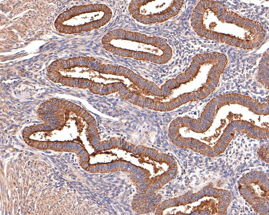 Immunohistochemical analysis of paraffin-embedded human endometrium tissue with Rabbit anti-MUC16 antibody (ET1611-74) at 1/400 dilution.<br />
<br />
The section was pre-treated using heat mediated antigen retrieval with Tris-EDTA buffer (pH 9.0) for 20 minutes. The tissues were blocked in 1% BSA for 20 minutes at room temperature, washed with ddH2O and PBS, and then probed with the primary antibody (ET1611-74) at 1/400 dilution for 1 hour at room temperature. The detection was performed using an HRP conjugated compact polymer system. DAB was used as the chromogen. Tissues were counterstained with hematoxylin and mounted with DPX.
