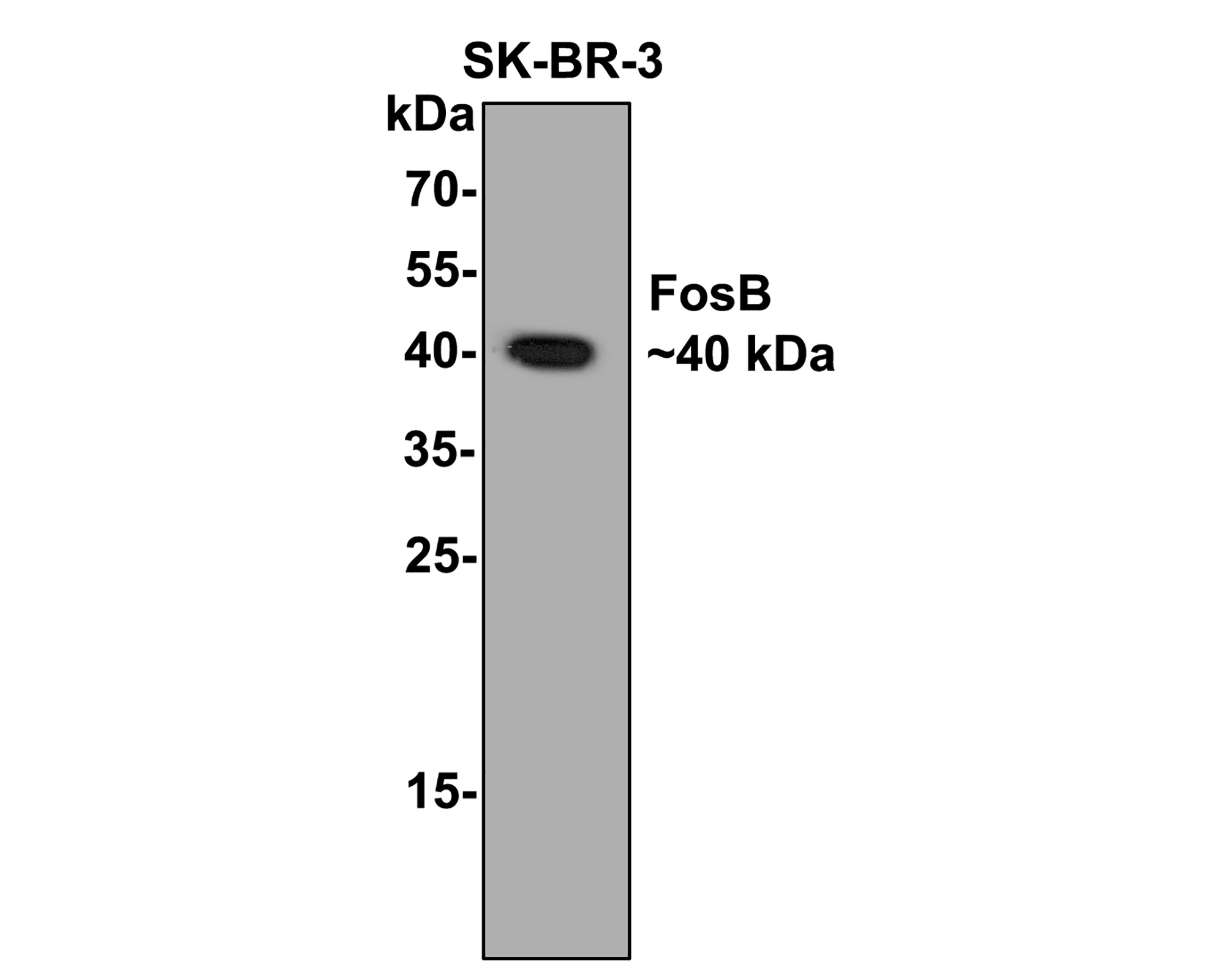 Western blot analysis of FosB on SK-Br-3 cell lysates with Rabbit anti-FosB antibody (ET1611-75) at 1/500 dilution.<br />
<br />
Lysates/proteins at 10 µg/Lane.<br />
<br />
Predicted band size: 36 kDa<br />
Observed band size: 40 kDa<br />
<br />
Exposure time: 2 minutes;<br />
<br />
12% SDS-PAGE gel.<br />
<br />
Proteins were transferred to a PVDF membrane and blocked with 5% NFDM/TBST for 1 hour at room temperature. The primary antibody (ET1611-75) at 1/500 dilution was used in 5% NFDM/TBST at room temperature for 2 hours. Goat Anti-Rabbit IgG - HRP Secondary Antibody (HA1001) at 1:200,000 dilution was used for 1 hour at room temperature.