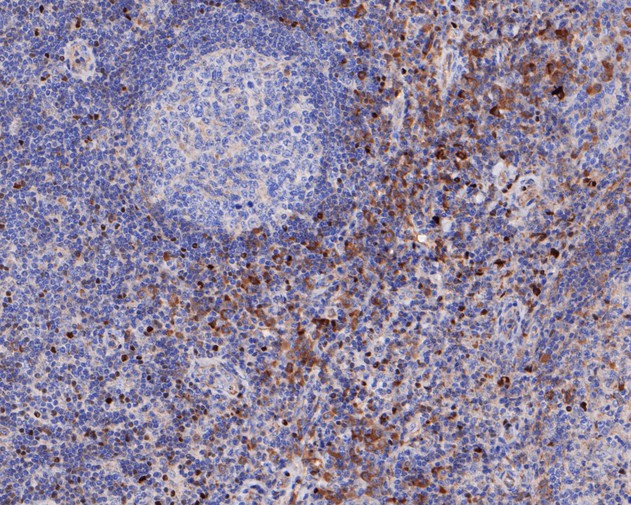 Immunohistochemical analysis of paraffin-embedded mouse hippocampus tissue with Rabbit anti-FosB antibody (ET1611-75) at 1/2,000 dilution.<br />
<br />
The section was pre-treated using heat mediated antigen retrieval with sodium citrate buffer (pH 6.0) for 2 minutes. The tissues were blocked in 1% BSA for 20 minutes at room temperature, washed with ddH2O and PBS, and then probed with the primary antibody (ET1611-75) at 1/2,000 dilution for 1 hour at room temperature. The detection was performed using an HRP conjugated compact polymer system. DAB was used as the chromogen. Tissues were counterstained with hematoxylin and mounted with DPX.