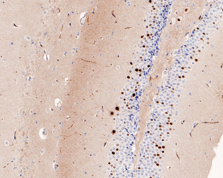 Immunohistochemical analysis of paraffin-embedded human tonsil tissue using anti-FosB antibody. The section was pre-treated using heat mediated antigen retrieval with sodium citrate buffer (pH 6.0) for 20 minutes. The tissues were blocked in 5% BSA for 30 minutes at room temperature, washed with ddH2O and PBS, and then probed with the primary antibody (ET1611-75, 1/50)  for 30 minutes at room temperature. The detection was performed using an HRP conjugated compact polymer system. DAB was used as the chromogen. Tissues were counterstained with hematoxylin and mounted with DPX.