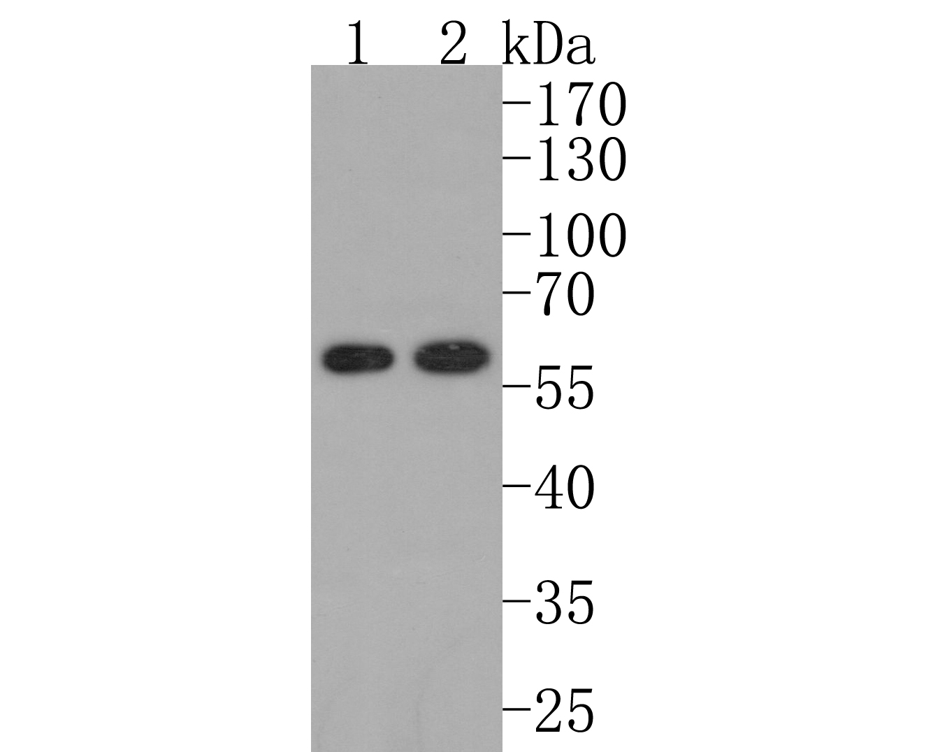 Western blot analysis of Retinoic Acid Receptor alpha on different lysates. Proteins were transferred to a PVDF membrane and blocked with 5% BSA in PBS for 1 hour at room temperature. The primary antibody (ET1611-77, 1/500) was used in 5% BSA at room temperature for 2 hours. Goat Anti-Rabbit IgG - HRP Secondary Antibody (HA1001) at 1:200,000 dilution was used for 1 hour at room temperature.<br />
Positive control: <br />
Lane 1: SK-Br-3 cell lysate<br />
Lane 2: MCF-7 cell lysate