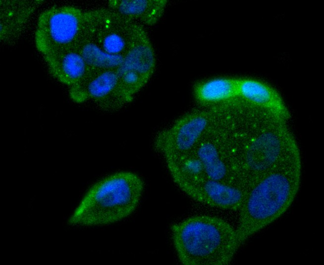 ICC staining of Bcl10 in MCF-7 cells (green). Formalin fixed cells were permeabilized with 0.1% Triton X-100 in TBS for 10 minutes at room temperature and blocked with 10% negative goat serum for 15 minutes at room temperature. Cells were probed with the primary antibody (ET1611-79, 1/50) for 1 hour at room temperature, washed with PBS. Alexa Fluor®488 conjugate-Goat anti-Rabbit IgG was used as the secondary antibody at 1/1,000 dilution. The nuclear counter stain is DAPI (blue).