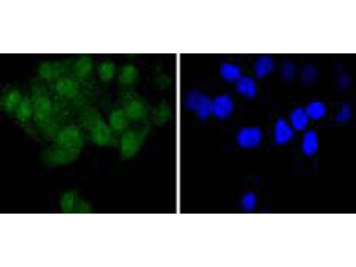 ICC staining of SHP2 in Hela cells (green). Formalin fixed cells were permeabilized with 0.1% Triton X-100 in TBS for 10 minutes at room temperature and blocked with 10% negative goat serum for 15 minutes at room temperature. Cells were probed with the primary antibody (ET1611-80, 1/50) for 1 hour at room temperature, washed with PBS. Alexa Fluor®488 conjugate-Goat anti-Rabbit IgG was used as the secondary antibody at 1/1,000 dilution. The nuclear counter stain is DAPI (blue).
