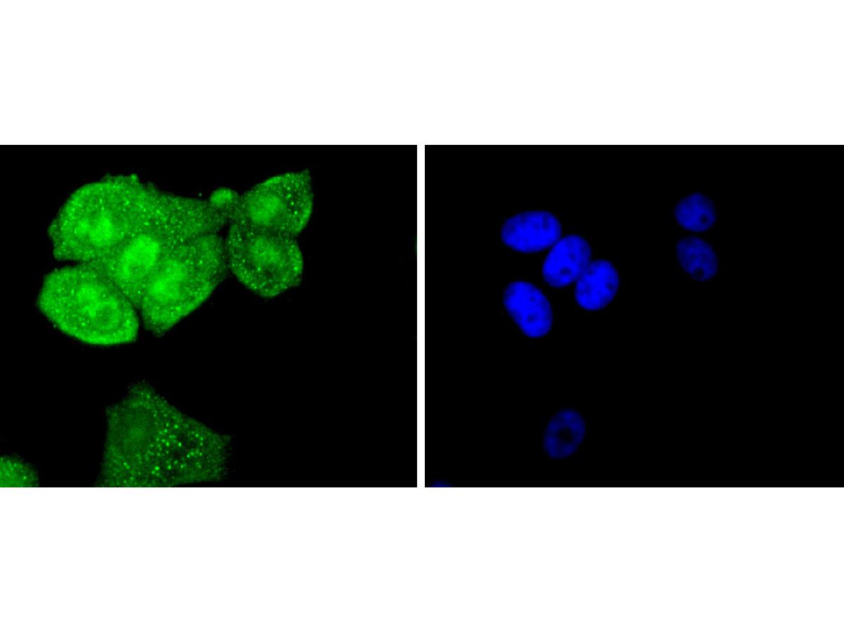ICC staining of SHP2 in MCF-7 cells (green). Formalin fixed cells were permeabilized with 0.1% Triton X-100 in TBS for 10 minutes at room temperature and blocked with 10% negative goat serum for 15 minutes at room temperature. Cells were probed with the primary antibody (ET1611-80, 1/50) for 1 hour at room temperature, washed with PBS. Alexa Fluor®488 conjugate-Goat anti-Rabbit IgG was used as the secondary antibody at 1/1,000 dilution. The nuclear counter stain is DAPI (blue).