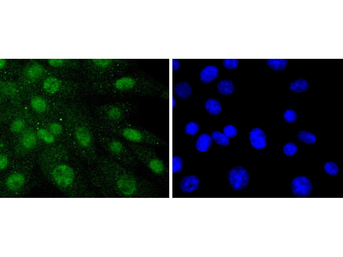 ICC staining of SHP2 in NIH/3T3 cells (green). Formalin fixed cells were permeabilized with 0.1% Triton X-100 in TBS for 10 minutes at room temperature and blocked with 10% negative goat serum for 15 minutes at room temperature. Cells were probed with the primary antibody (ET1611-80, 1/50) for 1 hour at room temperature, washed with PBS. Alexa Fluor®488 conjugate-Goat anti-Rabbit IgG was used as the secondary antibody at 1/1,000 dilution. The nuclear counter stain is DAPI (blue).