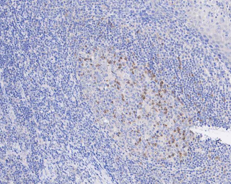 Immunohistochemical analysis of paraffin-embedded human kidney tissue using anti-SHP2 antibody. The section was pre-treated using heat mediated antigen retrieval with Tris-EDTA buffer (pH 9.0) for 20 minutes.The tissues were blocked in 1% BSA for 30 minutes at room temperature, washed with ddH2O and PBS, and then probed with the primary antibody (ET1611-80, 1/50) for 30 minutes at room temperature. The detection was performed using an HRP conjugated compact polymer system. DAB was used as the chromogen. Tissues were counterstained with hematoxylin and mounted with DPX.