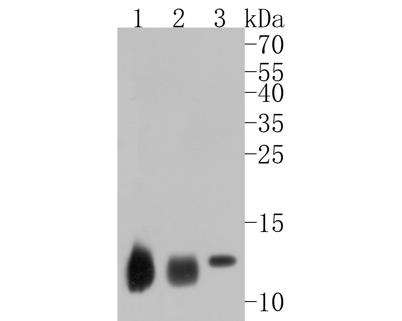Western blot analysis of Hemoglobin subunit alpha on different lysates. Proteins were transferred to a PVDF membrane and blocked with 5% BSA in PBS for 1 hour at room temperature. The primary antibody (ET1611-81, 1/500) was used in 5% BSA at room temperature for 2 hours. Goat Anti-Rabbit IgG - HRP Secondary Antibody (HA1001) at 1:5,000 dilution was used for 1 hour at room temperature.<br />
<br />
Positive control: <br />
Lane 1: human heart tissue lysate<br />
Lane 2: human spleen tissue lysate<br />
Lane 3: rat heart tissue lysate<br />
<br />
Predicted band size: 15 kDa<br />
Observed band size: 13 kDa