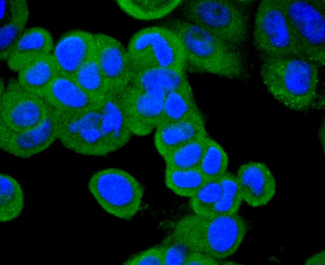 ICC staining of CD10 in MCF-7 cells (green). Formalin fixed cells were permeabilized with 0.1% Triton X-100 in TBS for 10 minutes at room temperature and blocked with 1% Blocker BSA for 15 minutes at room temperature. Cells were probed with the primary antibody (ET1611-82, 1/50) for 1 hour at room temperature, washed with PBS. Alexa Fluor®488 Goat anti-Rabbit IgG was used as the secondary antibody at 1/1,000 dilution. The nuclear counter stain is DAPI (blue).