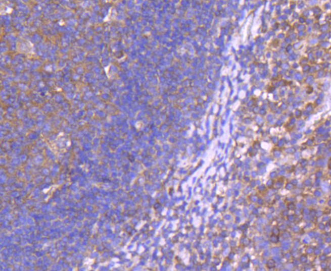 Immunohistochemical analysis of paraffin-embedded human tonsil tissue using anti-CD10 antibody. The section was pre-treated using heat mediated antigen retrieval with Tris-EDTA buffer (pH 8.0-8.4) for 20 minutes.The tissues were blocked in 5% BSA for 30 minutes at room temperature, washed with ddH2O and PBS, and then probed with the primary antibody (ET1611-82, 1/50) for 30 minutes at room temperature. The detection was performed using an HRP conjugated compact polymer system. DAB was used as the chromogen. Tissues were counterstained with hematoxylin and mounted with DPX.