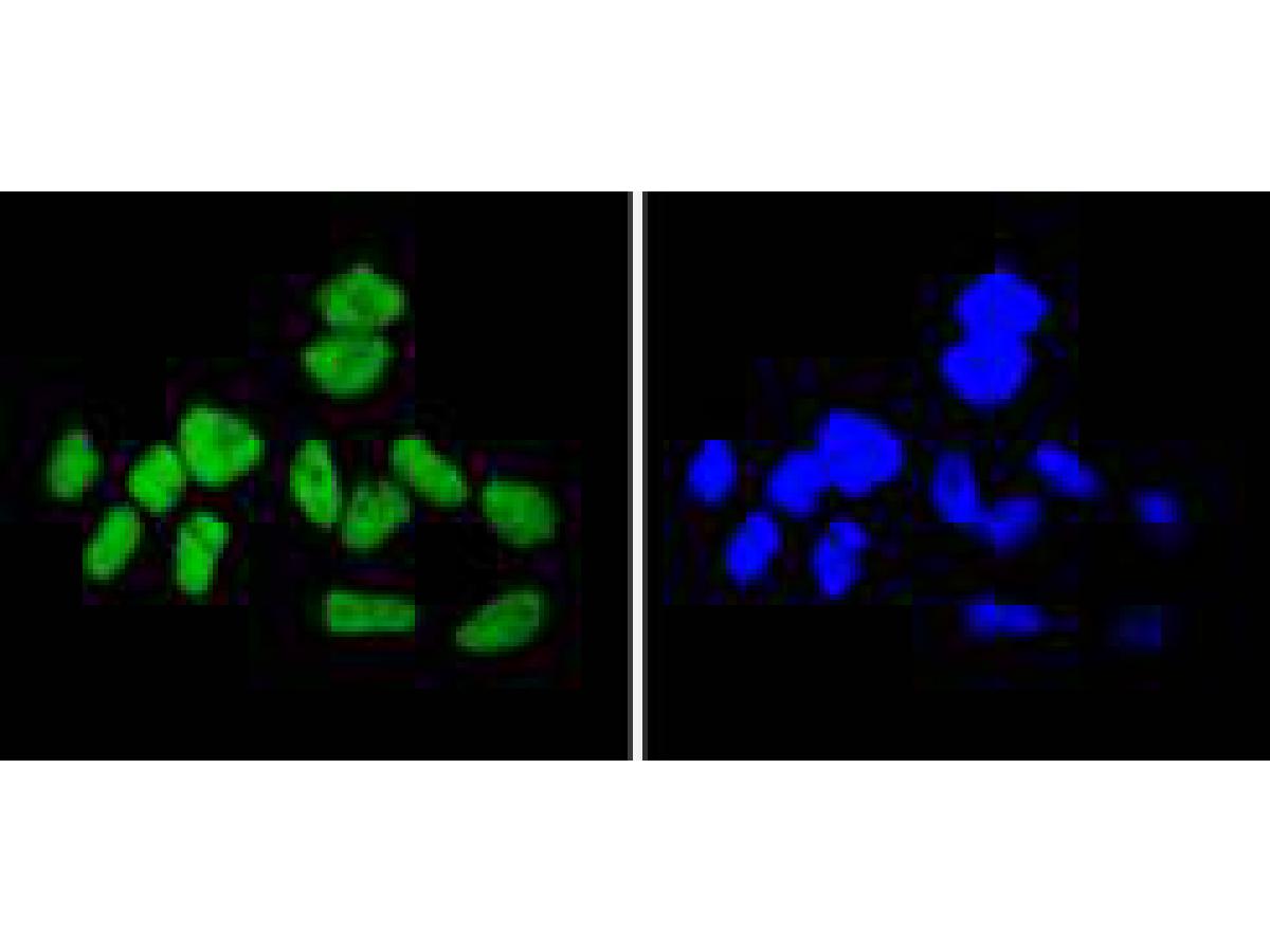ICC staining Cyclin H in Hela cells (green). The nuclear counter stain is DAPI (blue). Cells were fixed in paraformaldehyde, permeabilised with 0.25% Triton X100/PBS.