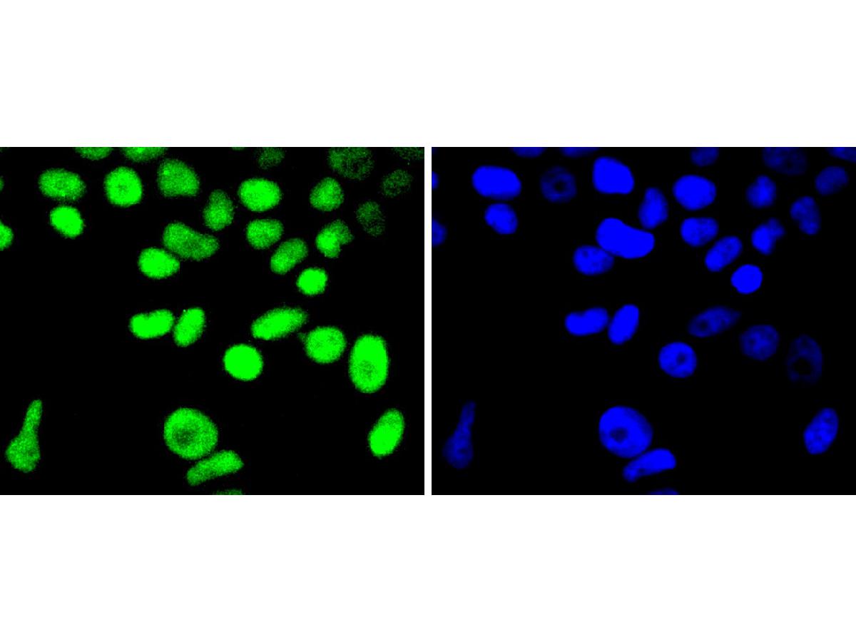 ICC staining Cyclin H in MCF-7 cells (green). The nuclear counter stain is DAPI (blue). Cells were fixed in paraformaldehyde, permeabilised with 0.25% Triton X100/PBS.