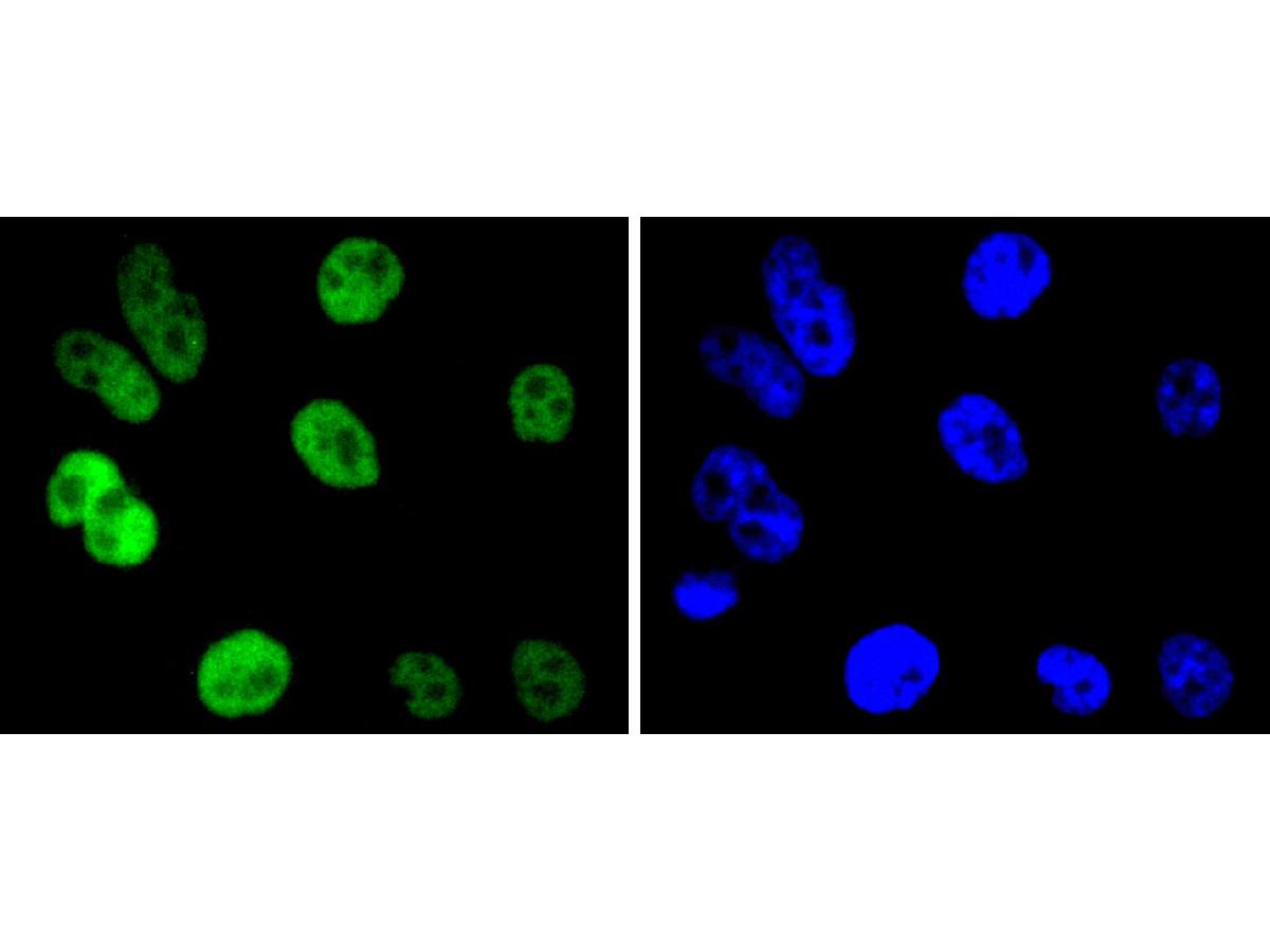 ICC staining Cyclin H in PC-3M cells (green). The nuclear counter stain is DAPI (blue). Cells were fixed in paraformaldehyde, permeabilised with 0.25% Triton X100/PBS.