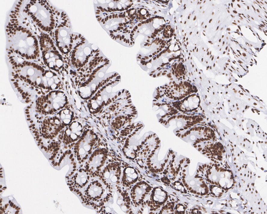 Immunohistochemical analysis of paraffin-embedded mouse testis tissue with Rabbit anti-BRG1 antibody (ET1611-85) at 1/500 dilution.<br />
<br />
The section was pre-treated using heat mediated antigen retrieval with sodium citrate buffer (pH 6.0) for 2 minutes. The tissues were blocked in 1% BSA for 20 minutes at room temperature, washed with ddH2O and PBS, and then probed with the primary antibody (ET1611-85) at 1/500 dilution for 1 hour at room temperature. The detection was performed using an HRP conjugated compact polymer system. DAB was used as the chromogen. Tissues were counterstained with hematoxylin and mounted with DPX.