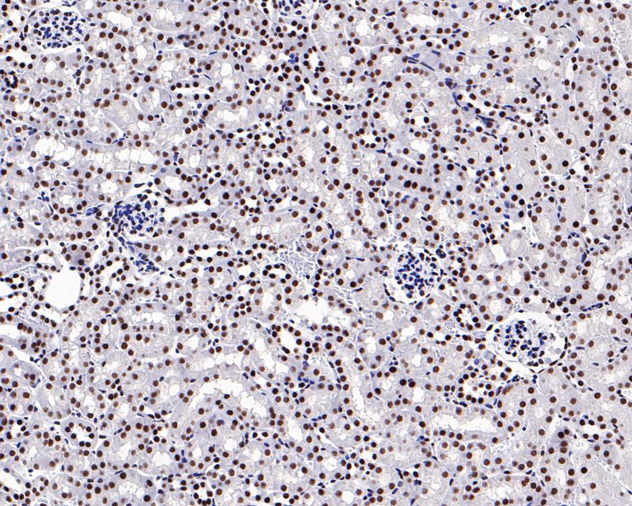 Immunohistochemical analysis of paraffin-embedded mouse colon tissue using anti-BRG1 antibody. The section was pre-treated using heat mediated antigen retrieval with Tris-EDTA buffer (pH 9.0) for 2 minutes.The tissues were blocked in 5% BSA for 30 minutes at room temperature, washed with ddH2O and PBS, and then probed with the primary antibody (ET1611-85, 1/50) for 30 minutes at room temperature. The detection was performed using an HRP conjugated compact polymer system. DAB was used as the chromogen. Tissues were counterstained with hematoxylin and mounted with DPX.