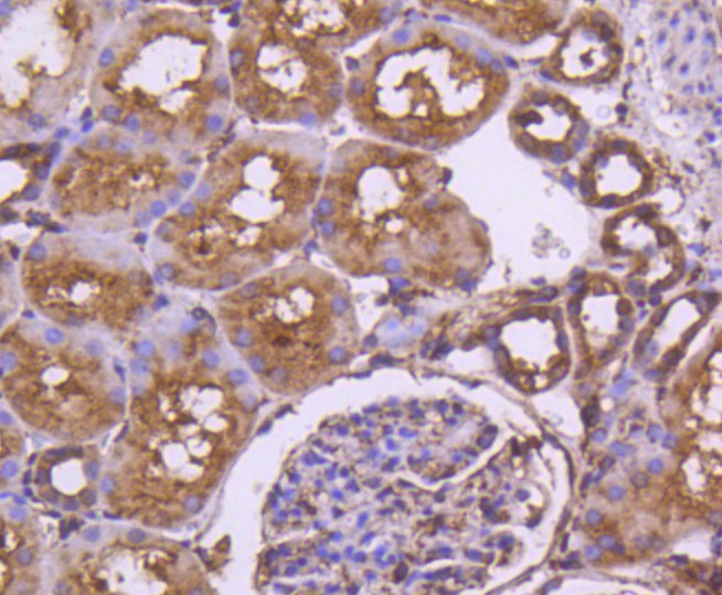 Immunohistochemical analysis of paraffin-embedded rat kidney tissue using anti-Calnexin antibody. The section was pre-treated using heat mediated antigen retrieval with Tris-EDTA buffer (pH 8.0-8.4) for 20 minutes.The tissues were blocked in 5% BSA for 30 minutes at room temperature, washed with ddH2O and PBS, and then probed with the primary antibody (ET1611-86, 1/50) for 30 minutes at room temperature. The detection was performed using an HRP conjugated compact polymer system. DAB was used as the chromogen. Tissues were counterstained with hematoxylin and mounted with DPX.