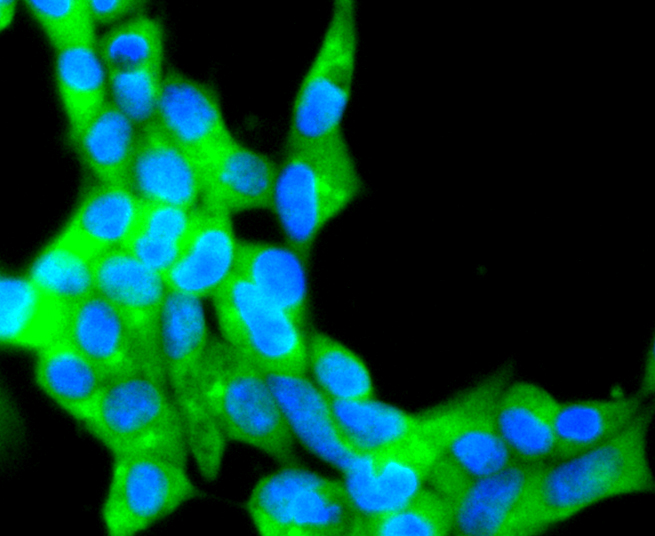 ICC staining of TAPA1/CD81 in 293 cells (green). Formalin fixed cells were permeabilized with 0.1% Triton X-100 in TBS for 10 minutes at room temperature and blocked with 1% Blocker BSA for 15 minutes at room temperature. Cells were probed with the primary antibody (ET1611-87, 1/50) for 1 hour at room temperature, washed with PBS. Alexa Fluor®488 Goat anti-Rabbit IgG was used as the secondary antibody at 1/1,000 dilution. The nuclear counter stain is DAPI (blue).