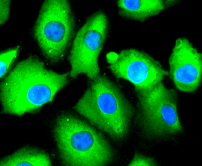 ICC staining of TAPA1/CD81 in A549 cells (green). Formalin fixed cells were permeabilized with 0.1% Triton X-100 in TBS for 10 minutes at room temperature and blocked with 1% Blocker BSA for 15 minutes at room temperature. Cells were probed with the primary antibody (ET1611-87, 1/50) for 1 hour at room temperature, washed with PBS. Alexa Fluor®488 Goat anti-Rabbit IgG was used as the secondary antibody at 1/1,000 dilution. The nuclear counter stain is DAPI (blue).