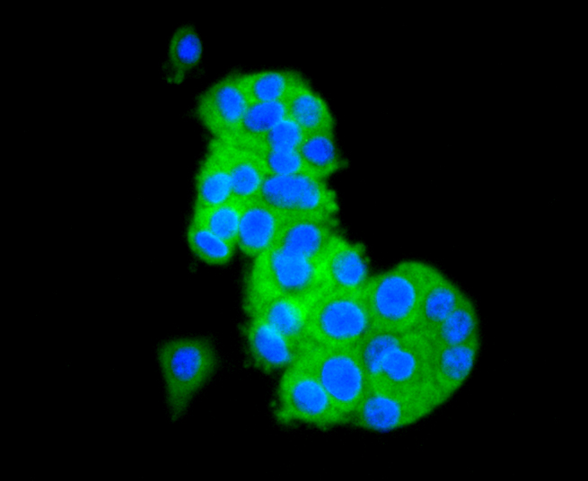 ICC staining of TAPA1/CD81 in PC-12 cells (green). Formalin fixed cells were permeabilized with 0.1% Triton X-100 in TBS for 10 minutes at room temperature and blocked with 1% Blocker BSA for 15 minutes at room temperature. Cells were probed with the primary antibody (ET1611-87, 1/50) for 1 hour at room temperature, washed with PBS. Alexa Fluor®488 Goat anti-Rabbit IgG was used as the secondary antibody at 1/1,000 dilution. The nuclear counter stain is DAPI (blue).