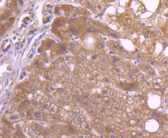 Immunohistochemical analysis of paraffin-embedded human liver tissue using anti-TAPA1/CD81 antibody. The section was pre-treated using heat mediated antigen retrieval with Tris-EDTA buffer (pH 8.0-8.4) for 20 minutes.The tissues were blocked in 5% BSA for 30 minutes at room temperature, washed with ddH2O and PBS, and then probed with the primary antibody (ET1611-87, 1/50) for 30 minutes at room temperature. The detection was performed using an HRP conjugated compact polymer system. DAB was used as the chromogen. Tissues were counterstained with hematoxylin and mounted with DPX.