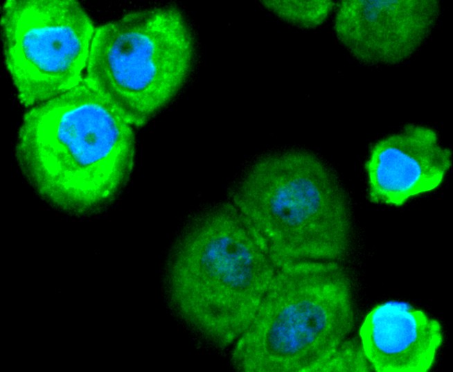 ICC staining SOX10 in A431 cells (green). The nuclear counter stain is DAPI (blue). Cells were fixed in paraformaldehyde, permeabilised with 0.25% Triton X100/PBS.
