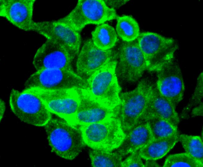 ICC staining SOX10 in HepG2 cells (green). The nuclear counter stain is DAPI (blue). Cells were fixed in paraformaldehyde, permeabilised with 0.25% Triton X100/PBS.
