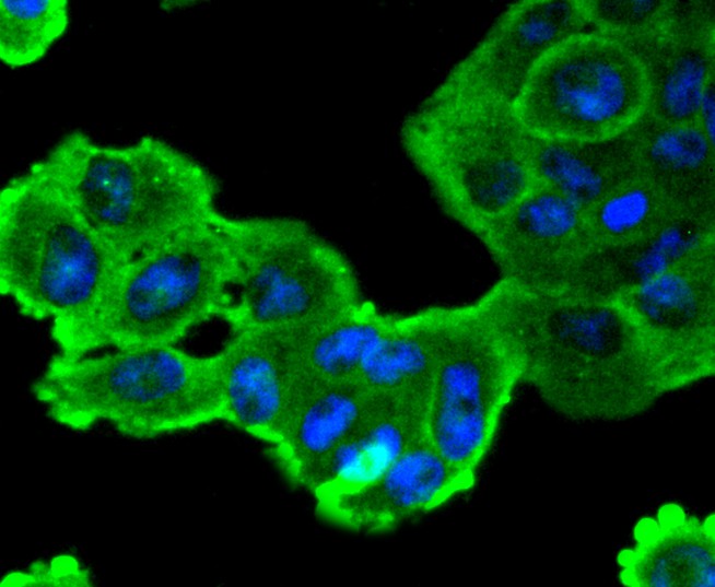 ICC staining SOX10 in RH-35 cells (green). The nuclear counter stain is DAPI (blue). Cells were fixed in paraformaldehyde, permeabilised with 0.25% Triton X100/PBS.