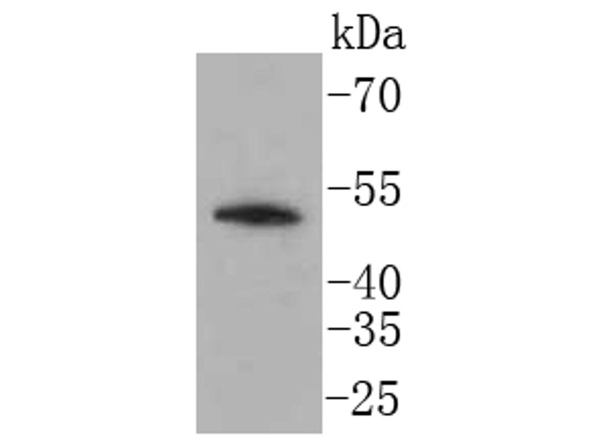 Western blot analysis of LSP1 on Daudi cell lysates. Proteins were transferred to a PVDF membrane and blocked with 5% BSA in PBS for 1 hour at room temperature. The primary antibody (ET1611-9, 1/500) was used in 5% BSA at room temperature for 2 hours. Goat Anti-Rabbit IgG - HRP Secondary Antibody (HA1001) at 1:200,000 dilution was used for 1 hour at room temperature.