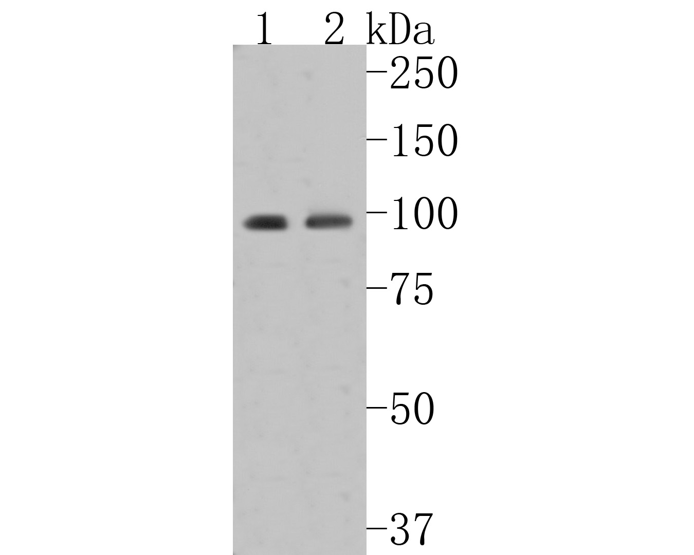 Western blot analysis of Insulin Receptor Beta on different lysates. Proteins were transferred to a PVDF membrane and blocked with 5% BSA in PBS for 1 hour at room temperature. The primary antibody (ET1611-90, 1/500) was used in 5% BSA at room temperature for 2 hours. Goat Anti-Rabbit IgG - HRP Secondary Antibody (HA1001) at 1:5,000 dilution was used for 1 hour at room temperature.<br />
Positive control: <br />
Lane 1: MCF-7 cell lysate<br />
Lane 2: 293 cell lysate<br />
<br />
Predicted band size: 156 kDa<br />
Observed band size: 100 kDa