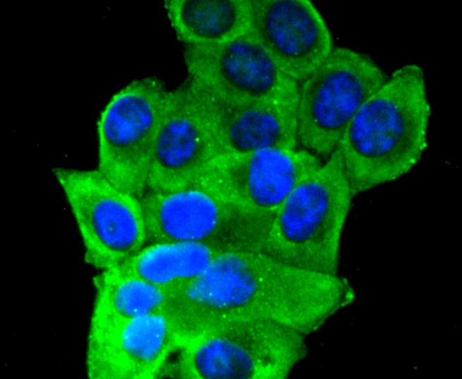 ICC staining of Insulin Receptor Beta in HepG2 cells (green). Formalin fixed cells were permeabilized with 0.1% Triton X-100 in TBS for 10 minutes at room temperature and blocked with 1% Blocker BSA for 15 minutes at room temperature. Cells were probed with the primary antibody (ET1611-90, 1/50) for 1 hour at room temperature, washed with PBS. Alexa Fluor®488 Goat anti-Rabbit IgG was used as the secondary antibody at 1/1,000 dilution. The nuclear counter stain is DAPI (blue).