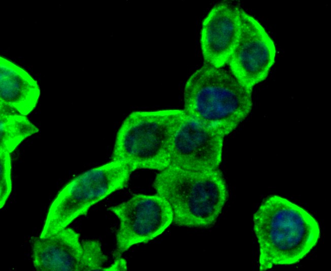 ICC staining of Insulin Receptor Beta in LO2 cells (green). Formalin fixed cells were permeabilized with 0.1% Triton X-100 in TBS for 10 minutes at room temperature and blocked with 1% Blocker BSA for 15 minutes at room temperature. Cells were probed with the primary antibody (ET1611-90, 1/50) for 1 hour at room temperature, washed with PBS. Alexa Fluor®488 Goat anti-Rabbit IgG was used as the secondary antibody at 1/1,000 dilution. The nuclear counter stain is DAPI (blue).
