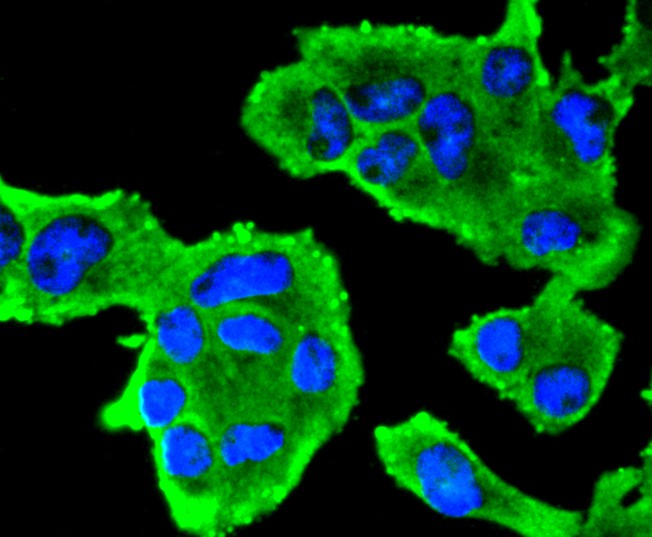 ICC staining of Insulin Receptor Beta in RH-35 cells (green). Formalin fixed cells were permeabilized with 0.1% Triton X-100 in TBS for 10 minutes at room temperature and blocked with 1% Blocker BSA for 15 minutes at room temperature. Cells were probed with the primary antibody (ET1611-90, 1/50) for 1 hour at room temperature, washed with PBS. Alexa Fluor®488 Goat anti-Rabbit IgG was used as the secondary antibody at 1/1,000 dilution. The nuclear counter stain is DAPI (blue).