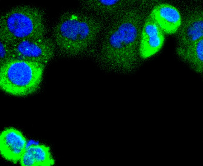ICC staining of Cytokeratin 4 in A431 cells (green). Formalin fixed cells were permeabilized with 0.1% Triton X-100 in TBS for 10 minutes at room temperature and blocked with 1% Blocker BSA for 15 minutes at room temperature. Cells were probed with the primary antibody (ET1611-91, 1/50) for 1 hour at room temperature, washed with PBS. Alexa Fluor®488 Goat anti-Rabbit IgG was used as the secondary antibody at 1/1,000 dilution. The nuclear counter stain is DAPI (blue).