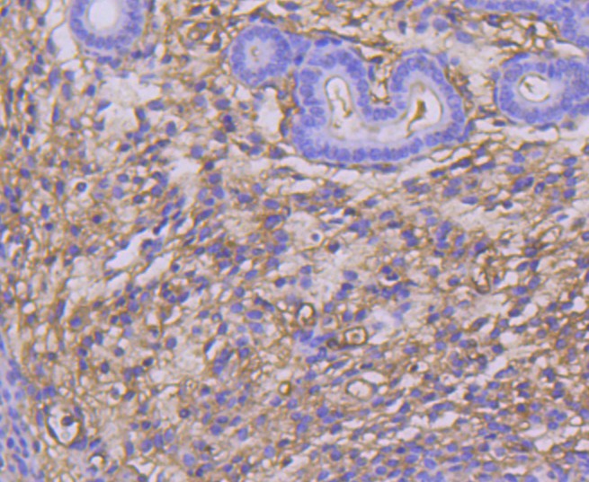 Immunohistochemical analysis of paraffin-embedded mouse uterus tissue using anti-TWEAKR antibody. Counter stained with hematoxylin.